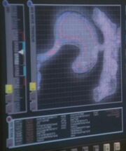 Porthos stomach scan