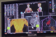 Lung cancer graphic display