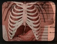 Diagramma anatomico dello scheletro del torso umano