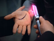 Dermal regenerator, 2374.jpg (44 KB) A different version (2374)