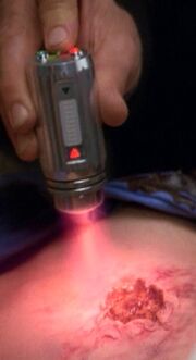 Vascular regenerator used on wound