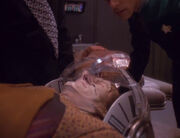 Garak's nosebleed