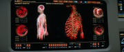 Cygnokemia scan