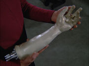 Data's arm