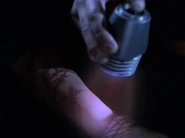 Dermal regenerator, 2376.jpg (8 KB) A different version (2376)