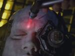 Laser scalpel on Borg