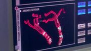 Anchilles fever pathogen