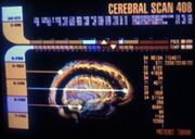 Vulcan brain Tuvok