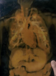 Human radiograph