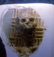 Dead Human in cryonic state 2.jpg (301 KB)