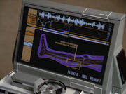 Riker's leg scan