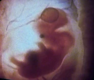 Ian Andrew Troi II embryo.jpg (33 KB) Ian Troi in embryonic state…