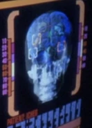 Icheb cerebral implant analysis.jpg (23 KB) Brunali cerebreal/implant analysis