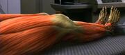 Vidiian leg muscles