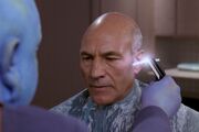 Picard sideburn trim