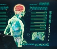 A medical scan showing Booker's anatomy