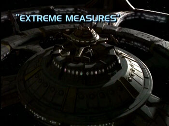 7x23 Extreme Measures title card