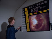 Pulaski displays fetal scan