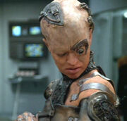 Seven of Nine with dermaplastic grafts