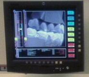 Scan of Vulcan teeth.