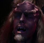 Klingon cranial ridges dissolve