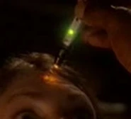 Dermal regenerator alternate timeline.jpg (5 KB) A different version (25th century, alternate timeline)