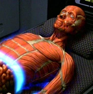 Vidiian muscles, upper body