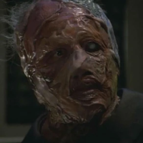 Dareth, a Vidiian male afflicted with the Phage (2371)