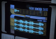 Swift, brain wave pattern
