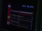 Picard's vitals