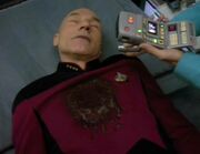 Picard damaged by compressed teryon beam