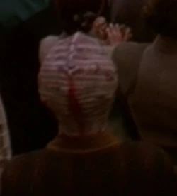 The back of the head