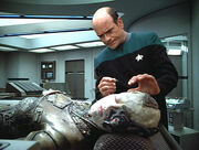 Seven of Nine in surgery to remove implants