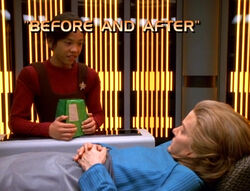 "Before and After"