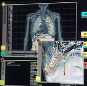 Triannon internal scan