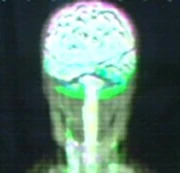 Diagrama de un cerebro de Aenar