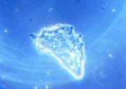 Amoeba