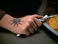 Seven Borg implant 4