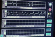 Borg biometric data