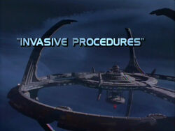 "Invasive Procedures"