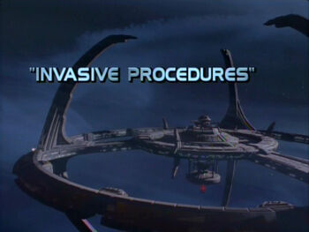 2x04 Invasive Procedures title card