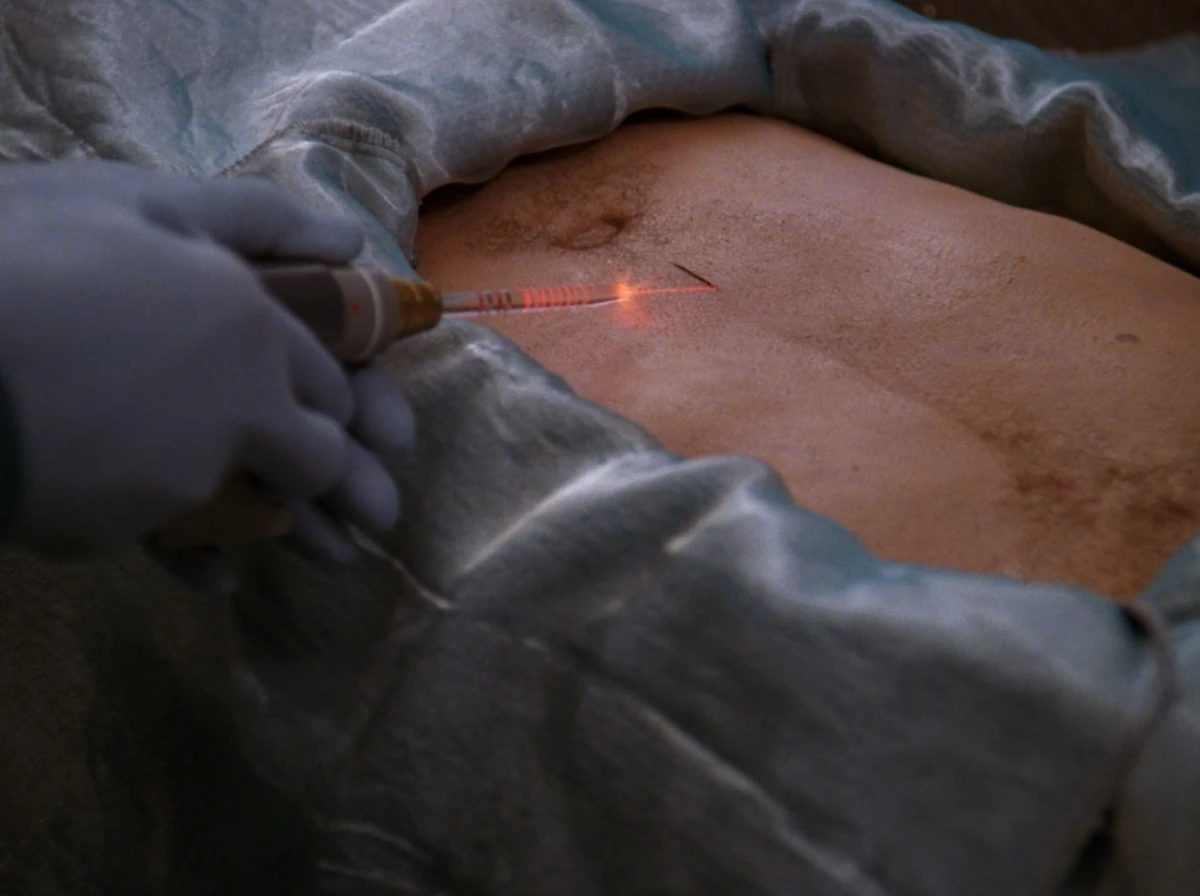 Laser scalpel Memory Alpha Fandom