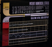 Realtime vital sign display