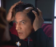 Chakotay losing hair