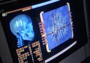 Bajoran skull scan