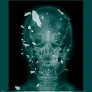 Venom Snake's skull X-ray.