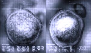 Two electron microscope images side by side.