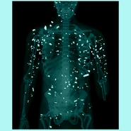 Venom Snake's body X-ray.