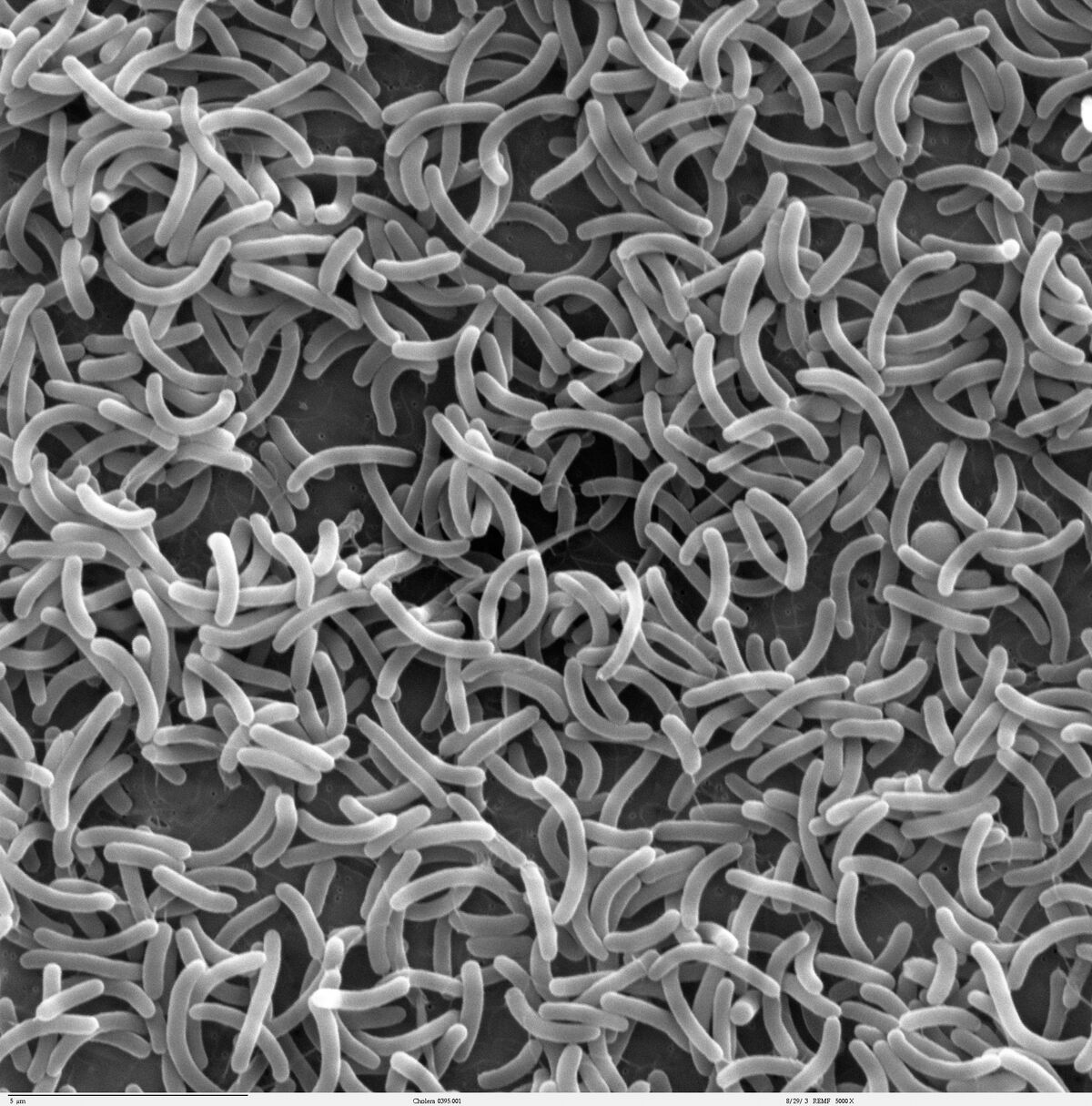 Scanning Electron Microscopy Microbiology Wiki Fandom