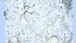 Param-biomdepthoffset-10